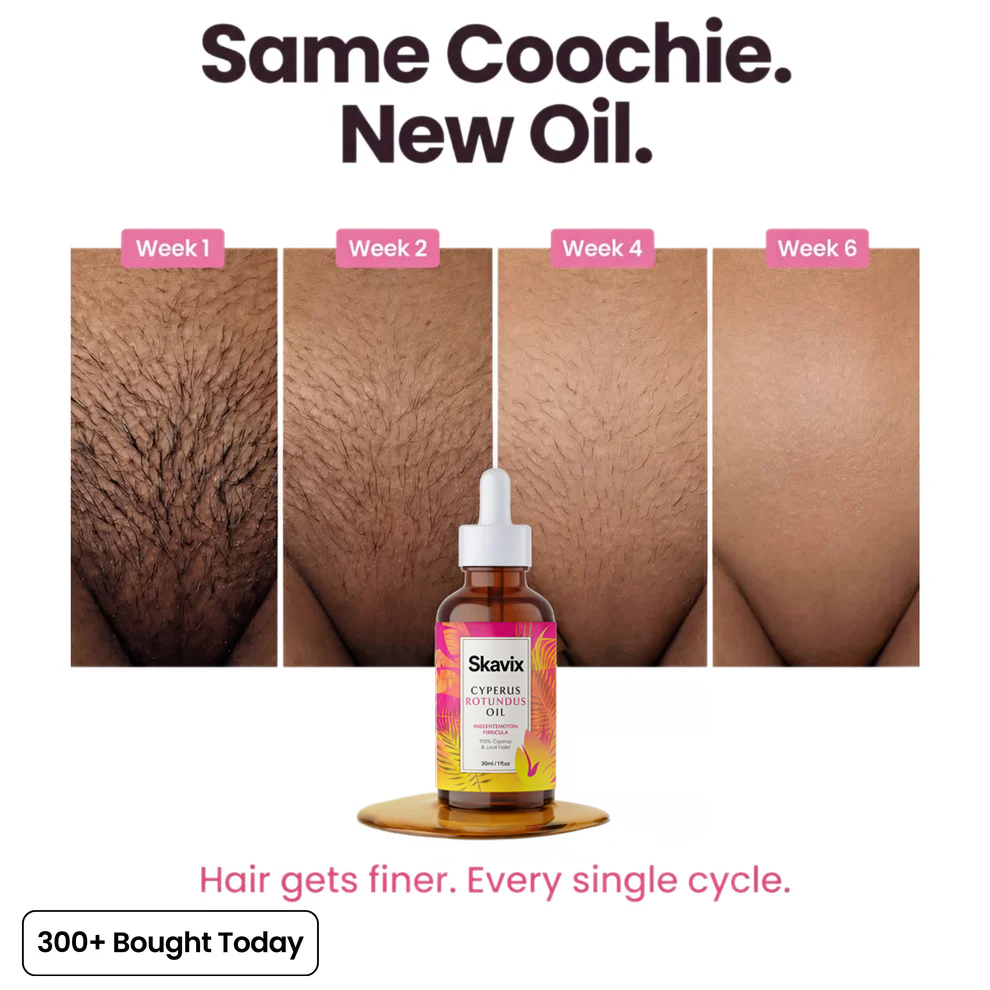 Anti-Hair Growth Oil ✨ Slower Regrowth, Smoother Skin