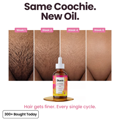 Anti-Hair Growth Oil ✨ Slower Regrowth, Smoother Skin