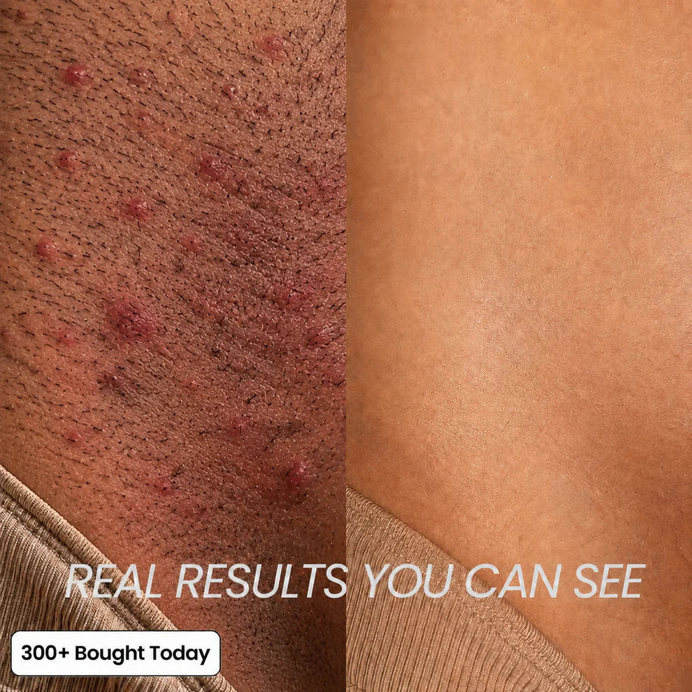 Anti-Hair Growth Oil ✨ Slower Regrowth, Smoother Skin