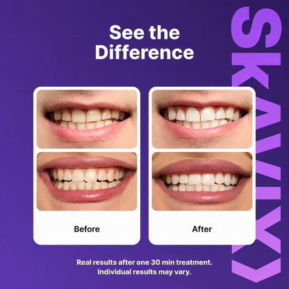 💜 Purple Teeth Whitening Strips | Peroxide-Free, Non-Sensitive Whitening for a Brighter Smile | 7/21 Sessions