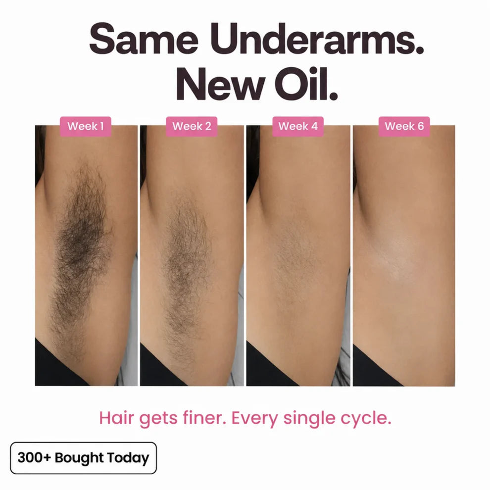 Anti-Hair Growth Oil ✨ Slower Regrowth, Smoother Skin