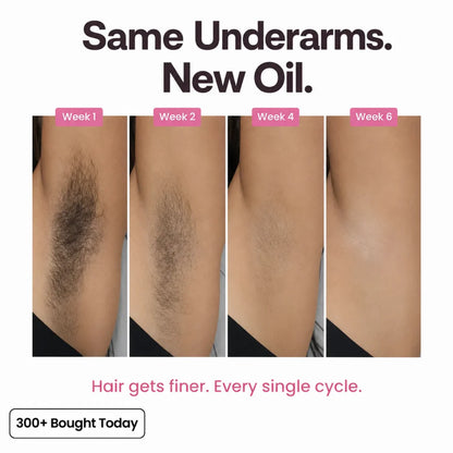 Anti-Hair Growth Oil ✨ Slower Regrowth, Smoother Skin